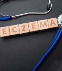 Eczema